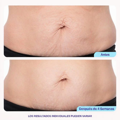 GOPURE™: Piel Lisa Sin Marcas