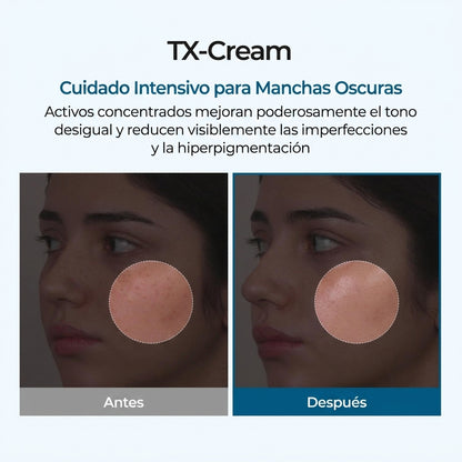 MELAXIN™: Piel Clara Sin Manchas